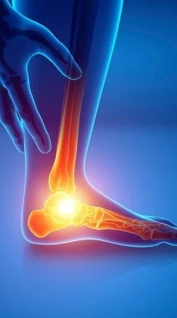 Lesiones de Pie y Tobillo