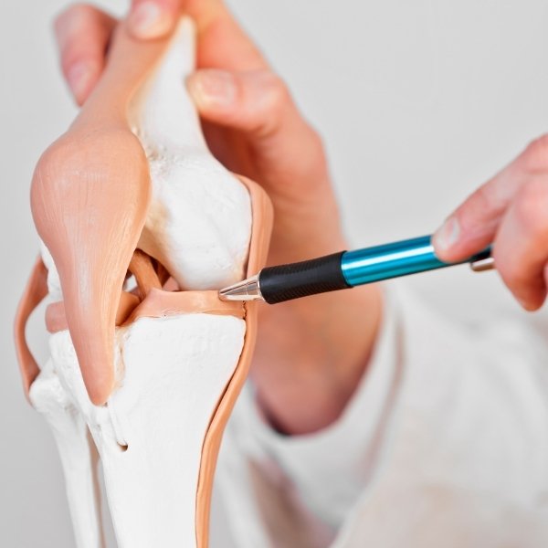 Tratamiento de Lesión de Menisco en Santa Cruz